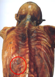 I tatuaggi scoperti sul corpo dell'uomo preistorico